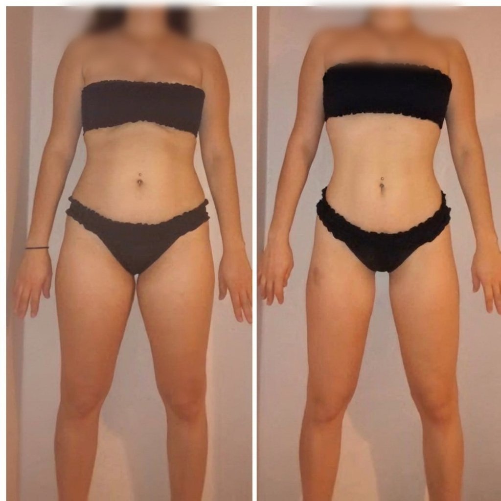 Estelle, 25 ans — transformation Renaissance 180