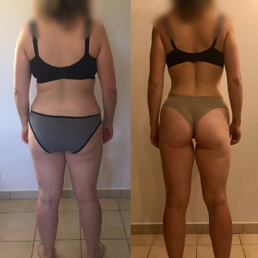 Lætitia, 35 ans — transformation Renaissance 180
